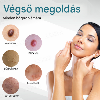 ✨Bikenda® non-invazív anyajegy- és szemölcseltávolító lézertoll💎