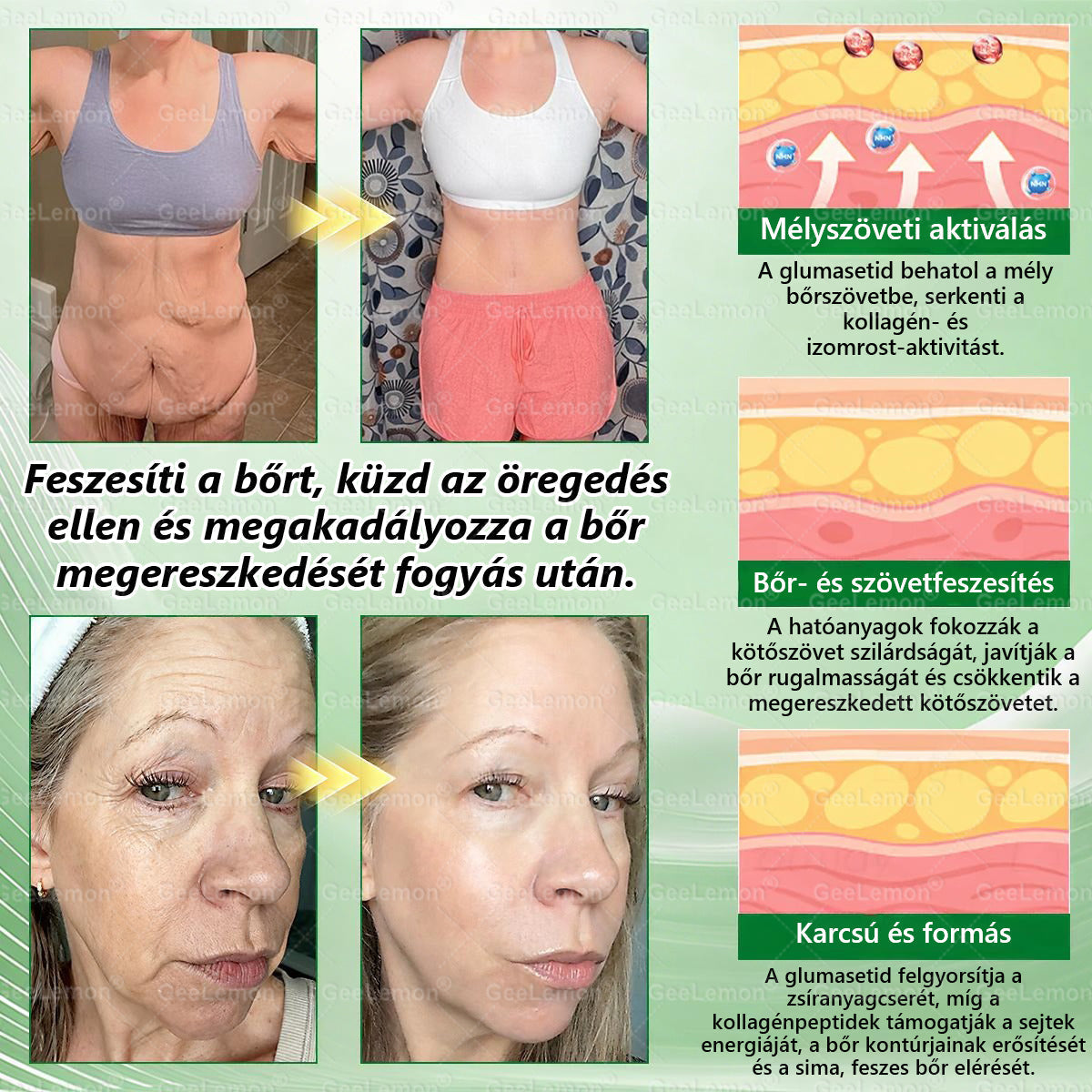 Ajánlott a Semmelweis Kórház által · BENU hivatalos üzlet| 👩‍⚕️ 𝐆𝐞𝑒𝐿𝑒𝐦𝐨𝐧® Glumasetide 8 az 1-ben Karcsú és Egészséges Nano Mikrotűs Tapasz