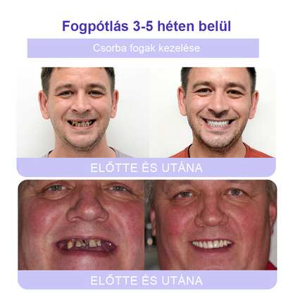 Cvreoz® Fogápoló Ásványi Por — 🦷Vége a lüktető fogfájásnak, érzékeny fogaknak és gyenge zománcnak, már az első használatok után (FDI ajánlott)