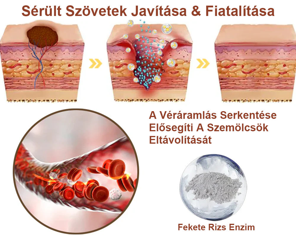Pureluxo® Fekete Rizses Bőrregeneráló Krém 👨‍⚕️ (Szemölcsök, bőrkinövések, foltok és hiperpigmentáció kezelésére)