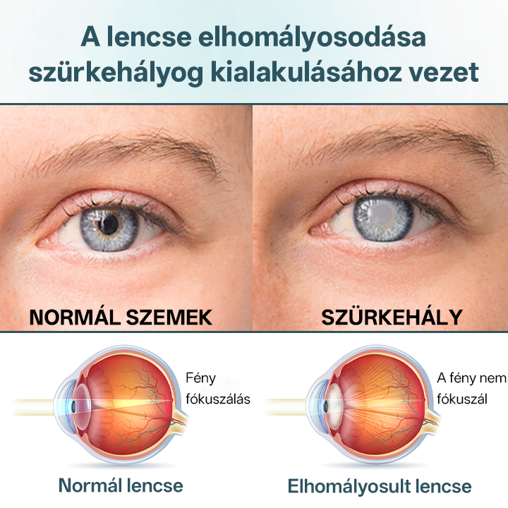 💎Timilk® OptiFusion Nano szemcsepp szérum