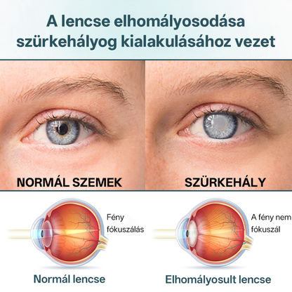 💎Timilk® OptiFusion Nano szemcsepp szérum