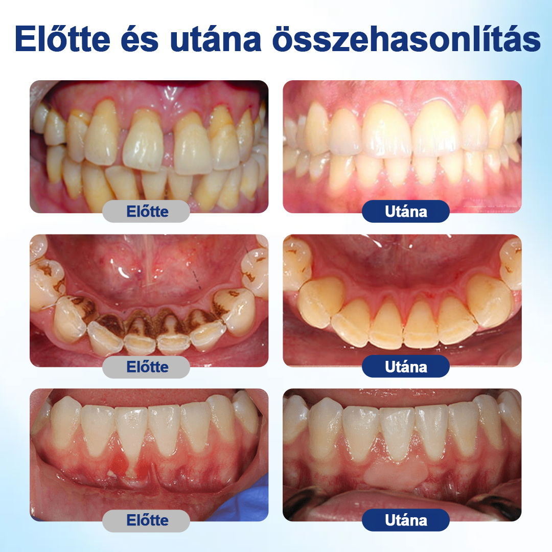 💎HEATWOLF® BeeTakt Szájápoló Regeneráló Oldat 🦷Fejlett bioaktív formula a szájüreg átfogó regeneráló támogatására