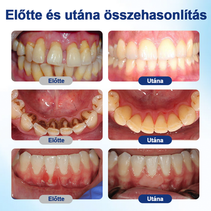 💎HEATWOLF® BeeTakt Szájápoló Regeneráló Oldat 🦷Fejlett bioaktív formula a szájüreg átfogó regeneráló támogatására