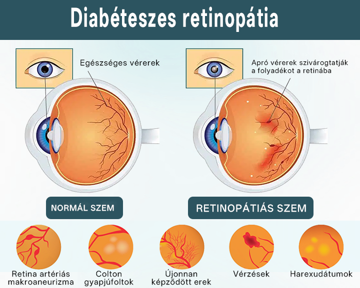 💎Timilk® OptiFusion Nano szemcsepp szérum