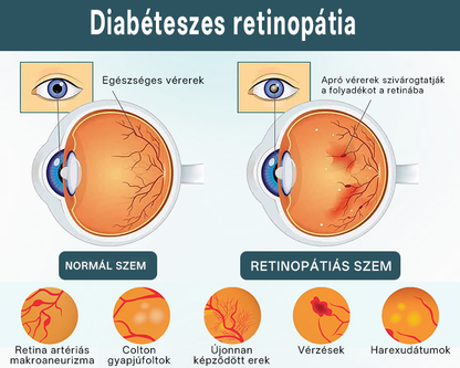 💎Timilk® OptiFusion Nano szemcsepp szérum