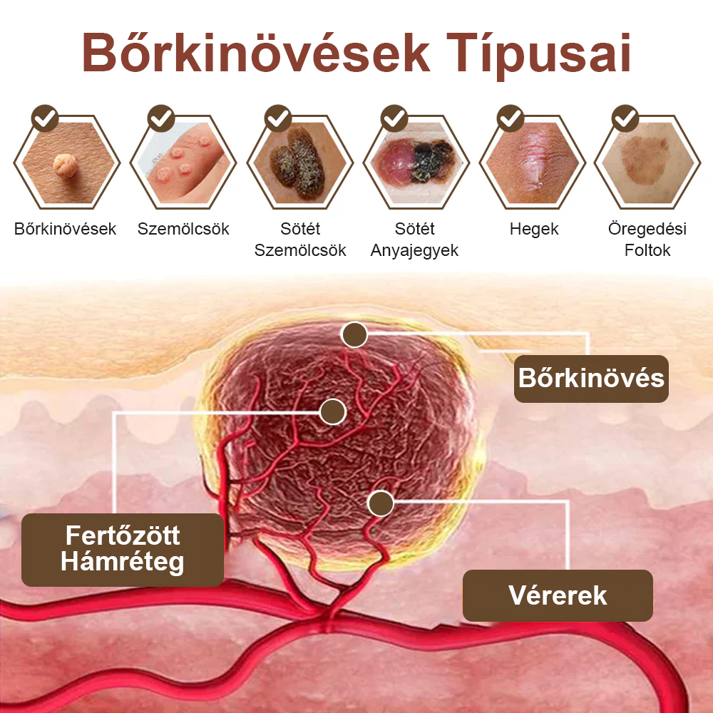 Pureluxo® Fekete Rizses Bőrregeneráló Krém 👨‍⚕️ (Szemölcsök, bőrkinövések, foltok és hiperpigmentáció kezelésére)
