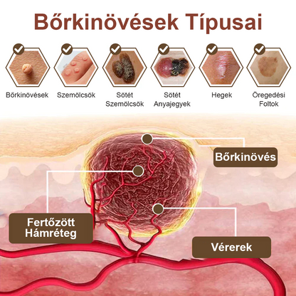 Pureluxo® Fekete Rizses Bőrregeneráló Krém 👨‍⚕️ (Szemölcsök, bőrkinövések, foltok és hiperpigmentáció kezelésére)