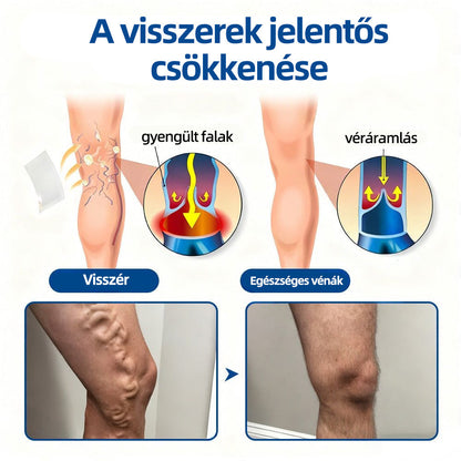 Healrize® Vénacélpont mikrotűs tapasz⚡Azonnali enyhülés hosszú távú eredmények🇭🇺