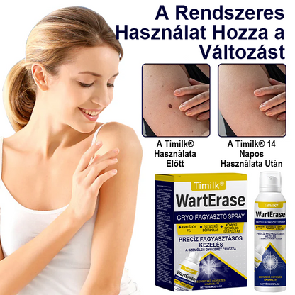 🎁Timilk® WartErase Fagyasztó Kriospray