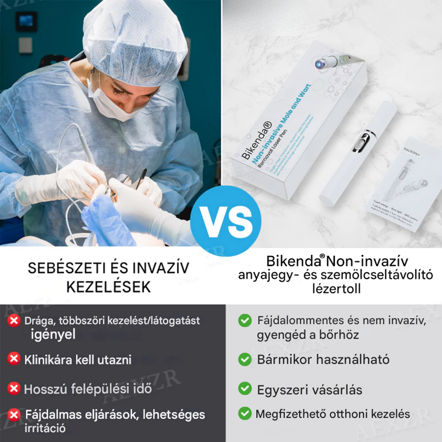 ✨Bikenda® non-invazív anyajegy- és szemölcseltávolító lézertoll💎