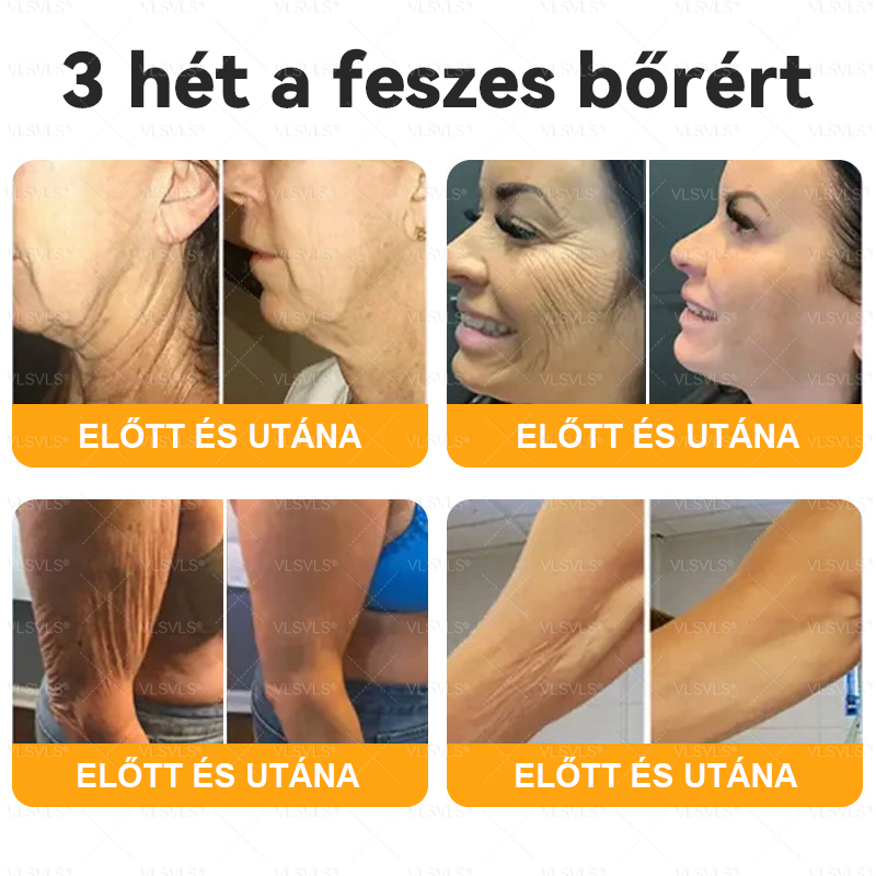 💎 VLSVLS® Méhméreg Bőrhelyreállító Krém 🔥 UTOLSÓ NAP – 80% KEDVEZMÉNY