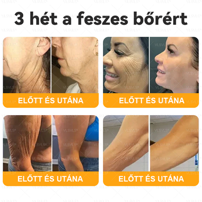 💎 VLSVLS® Méhméreg Bőrhelyreállító Krém 🔥 UTOLSÓ NAP – 80% KEDVEZMÉNY