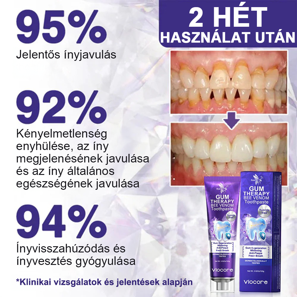 🌟Rolimey® VioCore Méhméreg Fogkezelő Fogkrém