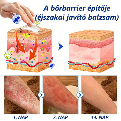 IEY® Pikkelysömör Nappal & Éjjel regeneráló készlet – fejlett bőrápoló rendszer, 100% szteroidmentes duó a bőr megnyugtatására és regenerálására