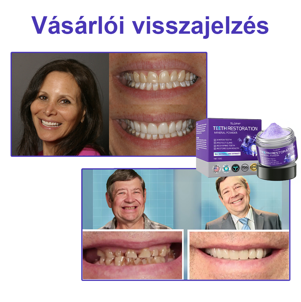 Cvreoz® Fogápoló Ásványi Por — 🦷Vége a lüktető fogfájásnak, érzékeny fogaknak és gyenge zománcnak, már az első használatok után (FDI ajánlott)