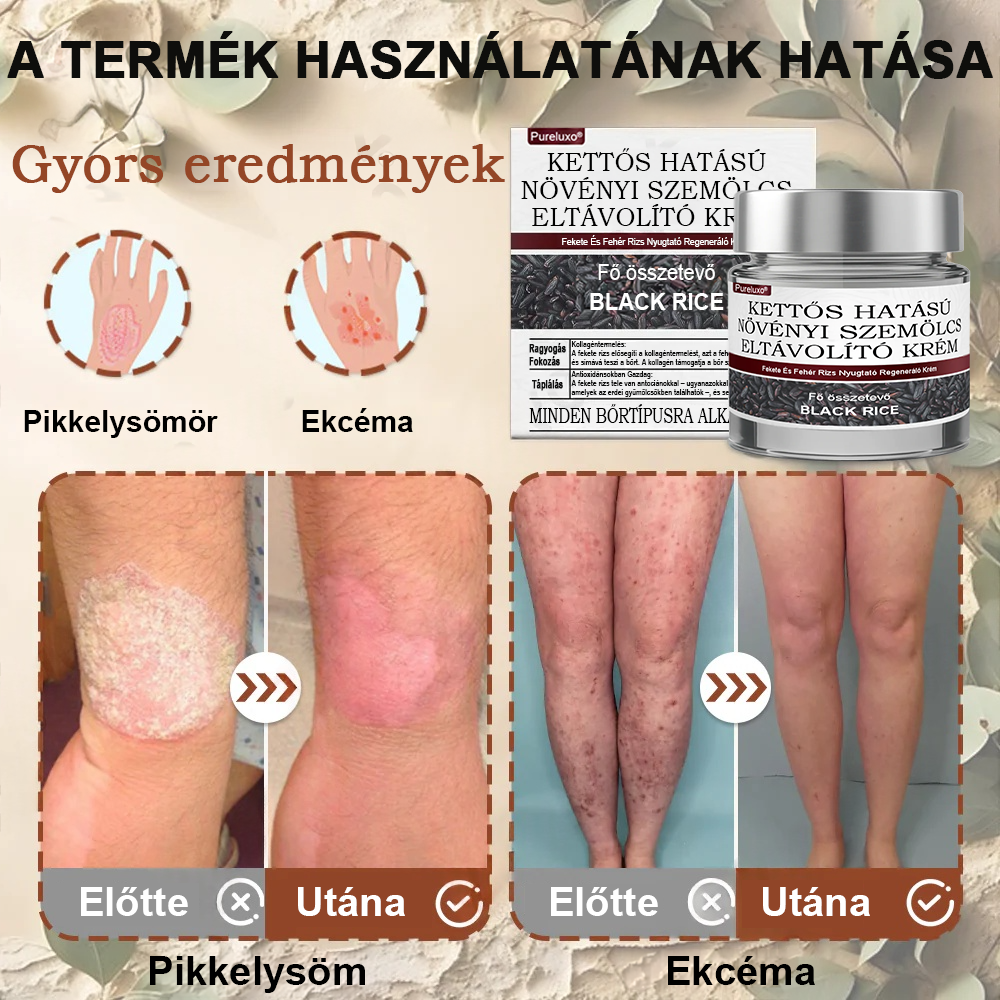 Pureluxo® Fekete Rizses Bőrregeneráló Krém 👨‍⚕️ (Szemölcsök, bőrkinövések, foltok és hiperpigmentáció kezelésére)
