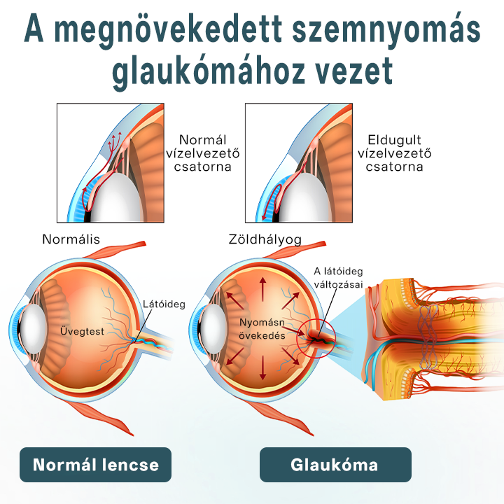 💎Timilk® OptiFusion Nano szemcsepp szérum